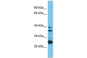 Western Blotting (WB) image for anti-Olfactory Receptor, Family 2, Subfamily A, Member 12 (OR2A12) (C-Term) antibody (ABIN2791718) (OR2A12 抗体  (C-Term))