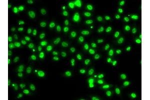 Immunofluorescence analysis of MCF7 cell using SETBP1 antibody. (SETBP1 抗体)