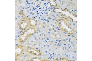 Immunohistochemistry of paraffin-embedded rat kidney using PMPCB antibody at dilution of 1:100 (x40 lens). (PMPCB 抗体)
