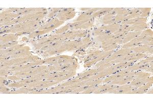 Immunohistochemistry (IHC) image for anti-Glypican 3 (GPC3) (AA 343-559) antibody (ABIN7426136)