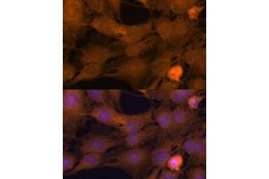 Immunofluorescence analysis of C6 cells using ZC3H7A antibody (ABIN6131068, ABIN6150400, ABIN6150401 and ABIN6217095) at dilution of 1:100. (ZC3H7A 抗体  (AA 1-220))