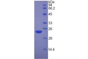 SDS-PAGE of Protein Standard from the Kit (Highly purified E. (Nucleolin ELISA 试剂盒)