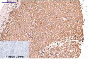 Immunohistochemical analysis of paraffin-embedded human liver tissue.