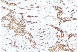 Immunohistochemistry (IHC) image for anti-Solute Carrier Family 30 (Zinc Transporter), Member 4 (SLC30A4) (Internal Region) antibody (ABIN6258421)