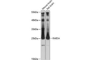 Western blot analysis of extracts of various cell lines, using RA antibody (ABIN7269809) at 1:3000 dilution. (RAB3A 抗体  (AA 100-200))