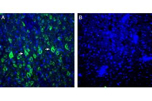 Expression of P2X6 in rat parietal cortex. (Purinergic Receptor P2X, Ligand-Gated Ion Channel, 6 (P2RX6) Peptide)