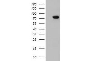 Western Blotting (WB) image for anti-rho GTPase Activating Protein 25 (ARHGAP25) antibody (ABIN1496704) (ARHGAP25 抗体)