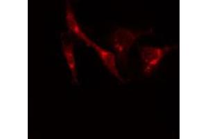 ABIN6274218 staining Hela cells by IF/ICC. (Calreticulin 抗体  (N-Term))