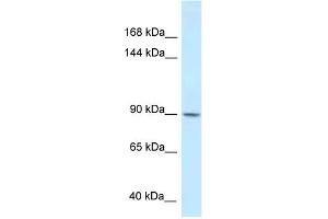 WB Suggested Anti-DACT1 Antibody Titration: 1. (DACT1 抗体  (Middle Region))