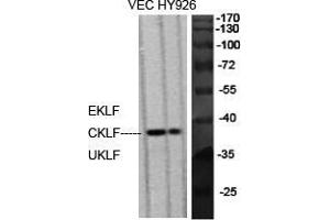 Western Blot (WB) analysis of specific cells using EKLF/CKLF/UKLF Polyclonal Antibody. (EKLF/CKLF/UKLF (C-Term) 抗体)