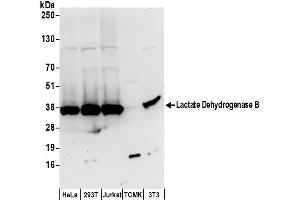 Western Blotting (WB) image for anti-Lactate Dehydrogenase B (LDHB) (AA 284-334) antibody (ABIN7450403)
