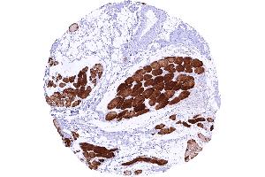 Skeletal muscle cells with a strong membranous and cytoplasmic TRIM72 staining
