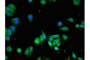 Immunofluorescent analysis of HepG2 cells using ABIN7170102 at dilution of 1:100 and Alexa Fluor 488-congugated AffiniPure Goat Anti-Rabbit IgG(H+L) (SLC13A5 抗体  (AA 156-204))