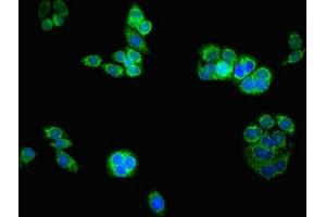 Immunofluorescent analysis of PC-3 cells using ABIN7145043 at dilution of 1:100 and Alexa Fluor 488-congugated AffiniPure Goat Anti-Rabbit IgG(H+L) (ATAD3B 抗体  (AA 1-240))