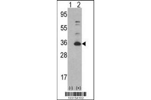 Western blot analysis of CDK4 using rabbit polyclonal CDK4 Antibody using 293 cell lysates (2 ug/lane) either nontransfected (Lane 1) or transiently transfected with the CDK4 gene (Lane 2). (CDK4 抗体  (C-Term))