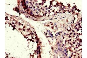 Immunohistochemistry of paraffin-embedded human testis tissue using ABIN7172803 at dilution of 1:100 (TACC3 抗体  (AA 133-268))