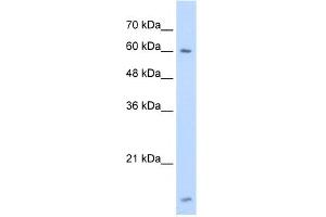 WB Suggested Anti-HNRPL Antibody Titration:  1. (HNRNPL 抗体  (N-Term))