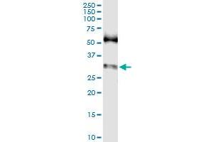 Immunoprecipitation (IP) image for anti-SNAIL (SNAI1) (AA 1-264) antibody (ABIN520324)