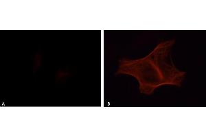 Immunofluorescence analysis of HeLa transfected cells stained with the anti-phospho-Tau (Tyr18) antibody, 1:200 dilution:  A: Tau,  B: Tau + Fyn (tau 抗体  (pTyr18))