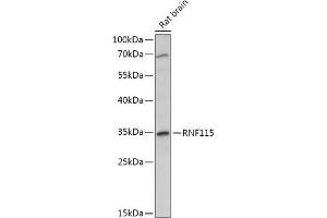 Western blot analysis of extracts of Rat brain, using RNF115 antibody (ABIN7270056) at 1:1000 dilution. (RNF115 抗体  (AA 30-140))