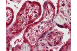 Immunohistochemistry (IHC) image for anti-Pleckstrin Homology Domain Containing, Family A (Phosphoinositide Binding Specific) Member 8 (PLEKHA8) (C-Term) antibody (ABIN185103)