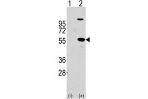Image no. 2 for anti-Aldehyde Dehydrogenase 1 Family, Member A1 (ALDH1A1) (Center) antibody (ABIN356973) (ALDH1A1 抗体  (Center))