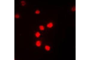 Immunofluorescent analysis of ZNF682 staining in Jurkat cells. (ZNF682 抗体  (N-Term))