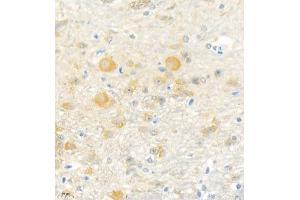 Immunohistochemistry analysis of paraffin embedded mouse cerebellum using Erc2 (ABIN7073808) at dilution of 1: 3000 (ERC2 抗体)