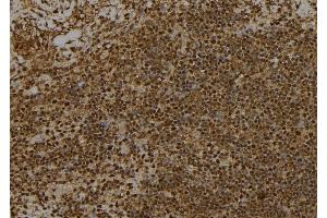 anti-Ribosomal Protein S6 Kinase, 90kDa, Polypeptide 1 (RPS6KA1) (pSer363), (pThr359) antibody