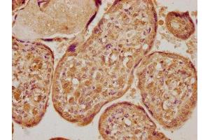 IHC image of ABIN7166428 diluted at 1:400 and staining in paraffin-embedded human placenta tissue performed on a Leica BondTM system. (LOX 抗体  (AA 23-285))