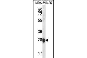 RAB27B Antibody (Center) (ABIN656670 and ABIN2845910) western blot analysis in MDA-M cell line lysates (35 μg/lane). (RAB27B 抗体  (AA 121-150))