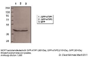 WB Suggested Anti-MTUS1 Antibody Titration:    Positive Control:  Total Cell Lysates (MTUS1 抗体  (N-Term))