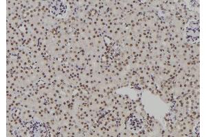 Immunohistochemistry (IHC) image for anti-Polymerase (RNA) II (DNA Directed) Polypeptide I, 14.5kDa (POLR2I) (Internal Region) antibody (ABIN6264346)