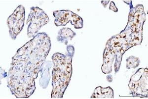 IHC analysis of Moesin/MSN using anti-Moesin/MSN antibody (ABIN7600379). (Moesin 抗体  (AA 184-568))