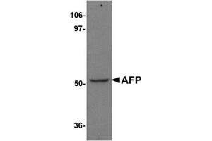 Western blot analysis of AFP in human liver tissue lysate with AFP Antibody (N-term) at 1 μg/ml. (alpha Fetoprotein 抗体  (N-Term))
