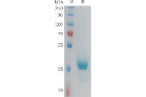 SDS-PAGE (SDS) image for Chemokine (C-X3-C Motif) Receptor 1 (CX3CR1) (AA 1-31) protein (Fc Tag) (ABIN6964249)
