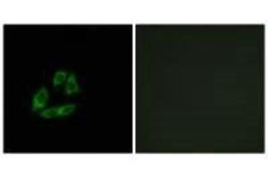 Immunofluorescence analysis of A549 cells, using ARFIP1 antibody. (ARFIP1 抗体)