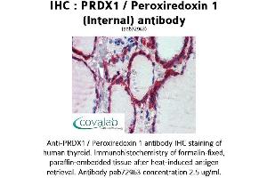Image no. 2 for anti-Peroxiredoxin 1 (PRDX1) (Internal Region) antibody (ABIN1738319) (Peroxiredoxin 1 抗体  (Internal Region))