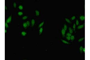 Immunofluorescence (IF) image for anti-Set1/Ash2 Histone Methyltransferase Complex Subunit ASH2 (ASH2L) (AA 1-534) antibody (ABIN7169424)