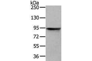 Gel: 6 % SDS-PAGE, Lysate: 40 μg, Lane: HT-29 cell, Primary antibody: ABIN7128081(VIL1 Antibody) at dilution 1/250 dilution, Secondary antibody: Goat anti rabbit IgG at 1/8000 dilution, Exposure time: 3 seconds (Villin 1 抗体)