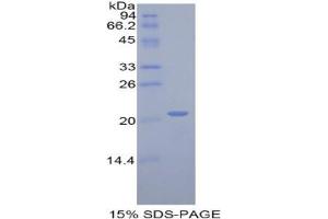 SDS-PAGE (SDS) image for Actin Related Protein 2/3 Complex, Subunit 4, 20kDa (ARPC4) protein (ABIN3008087)