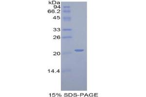 SDS-PAGE analysis of Rat ARPC4 Protein. (ARPC4 蛋白)