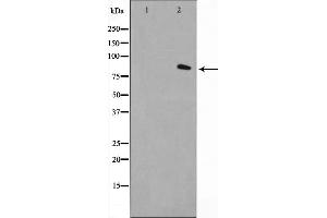 Western blot analysis on LOVO cell lysate using FAP-1 Antibody，The lane on the left is treated with the antigen-specific peptide.