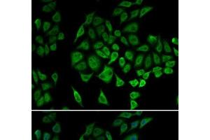 Immunofluorescence (IF) image for anti-NADH Dehydrogenase (Ubiquinone) Fe-S Protein 1, 75kDa (NADH-Coenzyme Q Reductase) (NDUFS1) antibody (ABIN7009564)