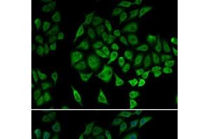 Immunofluorescence analysis of U2OS cells using NDUFS1 Polyclonal Antibody (NDUFS1 抗体)
