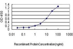 Detection limit for recombinant GST tagged CSE1L is approximately 0. (Exportin 2 抗体  (AA 872-971))