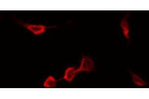 ABIN6267548 staining Hela by IF/ICC. (CCR5 抗体  (pSer336))