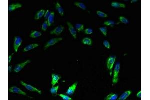 Immunofluorescence (IF) image for anti-ATPase, H+ Transporting, Lysosomal 31kDa, V1 Subunit E1 (ATP6V1E1) (AA 2-224) antibody (ABIN7175250)