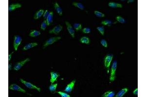 Immunofluorescent analysis of Hela cells using ABIN7175250 at dilution of 1:100 and Alexa Fluor 488-congugated AffiniPure Goat Anti-Rabbit IgG(H+L) (ATP6V1E1 抗体  (AA 2-224))