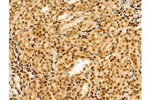 ABIN6257333 and ABIN6274335 at 1/100 staining Rat kidney tissue by IHC-P.